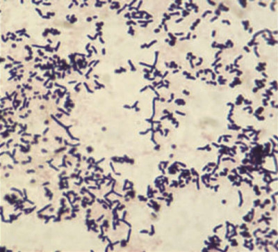 Gram Stain of Rothia dentocariosa