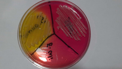 Mannitol Salt Agar with Growth of Staphylococcus aureus and CoNS