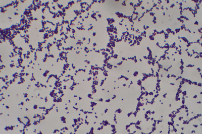 Staphylococcus aureus Gram Stain