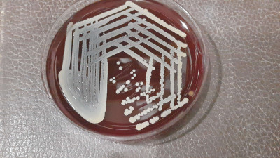 Staphylococcus aureus Growth on Blood Agar