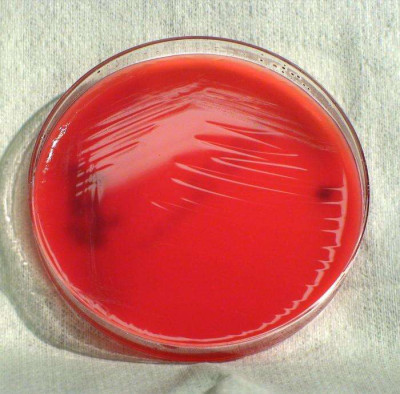 Kingella kingae on Sheep’s Blood Agar