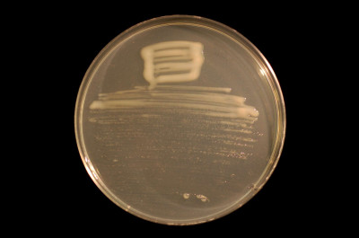 Mesorhizobium japonicum Strain MAFF303099 on TY Agar (Clean)