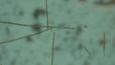 Planktothrix rubescens under Microscope