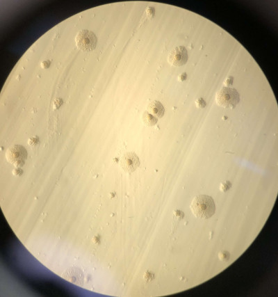 Mycoplasma Howe Bovine Mastitis