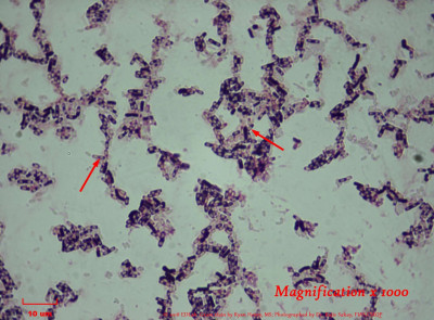 Bacillus flexus