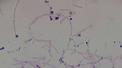 Spores of Bacteria Demonstration