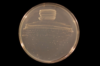 Bradyrhizobium diazoefficiens USDA 110 on TY agar