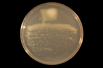 Sinorhizobium medicae on TY Agar