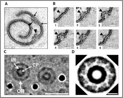 Architecture of the Gemmata obscuriglobus Pore