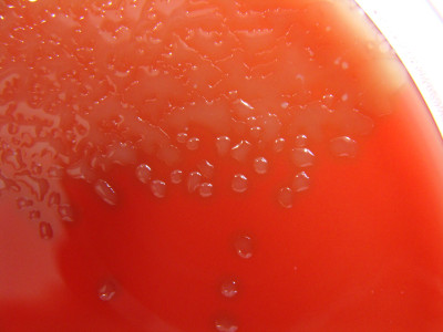 Streptococcus pneumoniae Columbia Agar