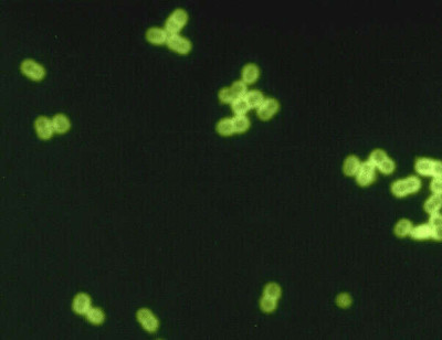 Streptococcus pneumoniae