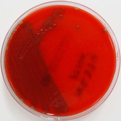 Streptococcus pneumoniae on Columbia Horse Blood Agar2