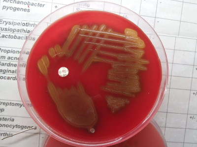 S. pneumoniae