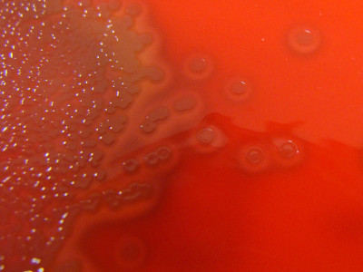 Streptococcus pneumoniae on Columbia Horse Blood Agar