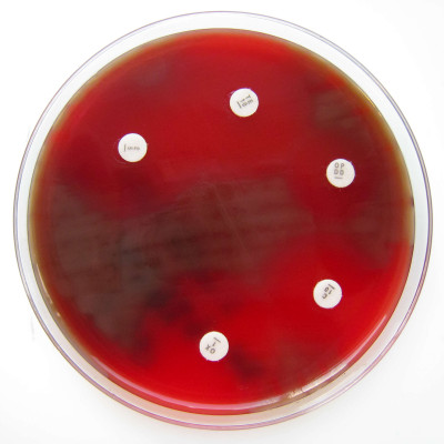 Sensitivity Testing Plate of Streptococcus pneumoniae