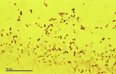 Pneumococcus (259 06)