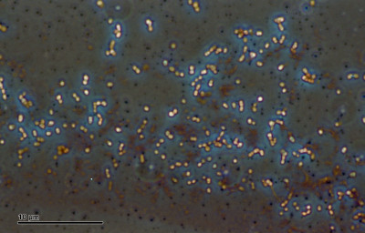 Pneumococcus