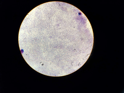 Diplococcus