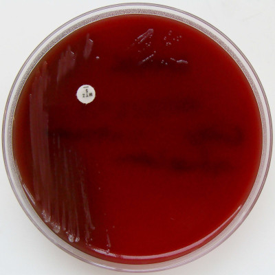 Bacteroides fragilis on Fastidious Anaerobe Agar - Sensitive to Metronidazole