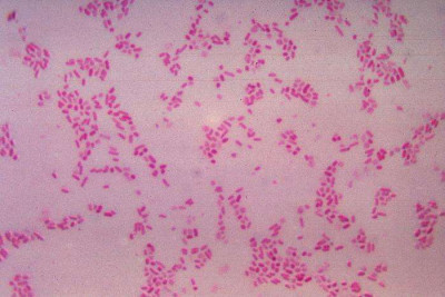 Bacteroides Fragilis Gram