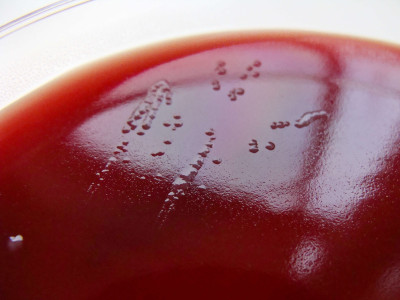 Bacteroides Fragilis on Fastidious Anaerobe Agar