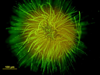 Gloeotrichia in Sytox