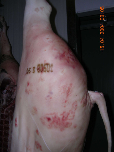 Skin Lesions of Erysipelas