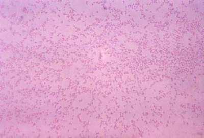 Pasteurella multocida Bacteria