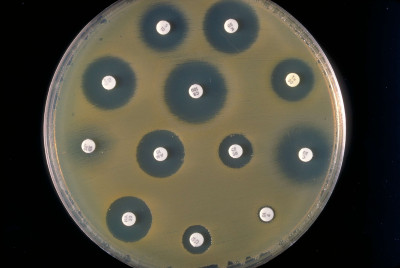 A Plate Culture of Enterobacter sakazakii