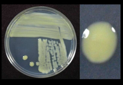 Xanthomonas Culture