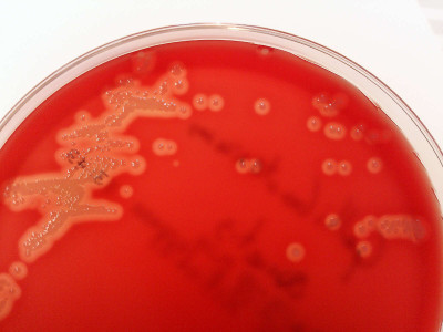 Gallibacterium anatis