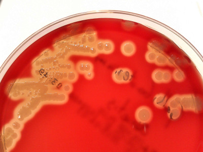 Gallibacterium anatis after 48h