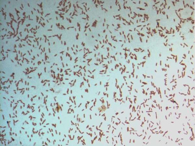 Gram staining of Dielma fastidiosa strain JC13 T