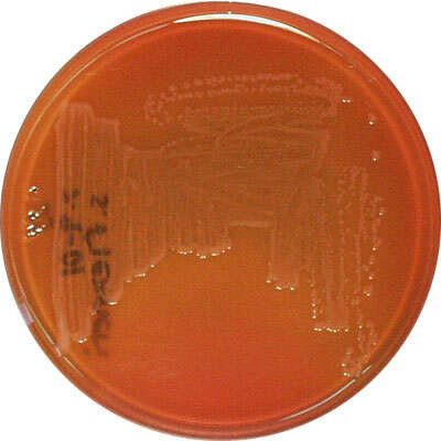 Medi Salmonella-Shigella (SS)