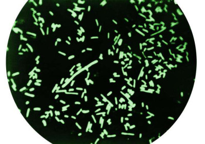 Dark Field Microscopy Revealing Shigella Dysenteriae Bacteria