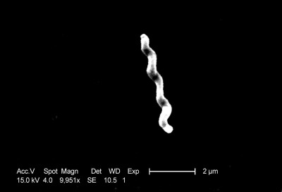 Campylobacter jejuni 01