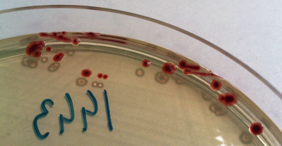 Campylobacter jejuni colonies