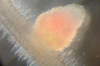 Closeup of a Dissected Medicago Root Nodule 2