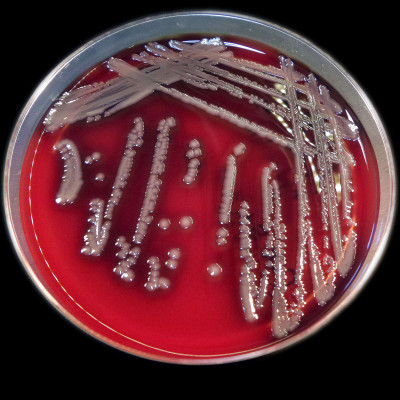 Aeromonas hydrophila colonies 01