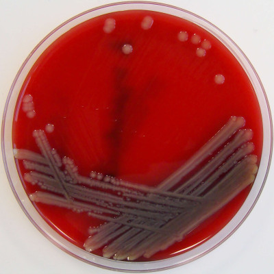 Aeromonas hydrophila on Columbia Horse Blood Agar