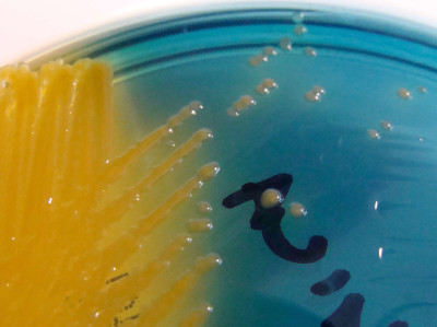 Aeromonas hydrophila on TCBS Agar - Detail