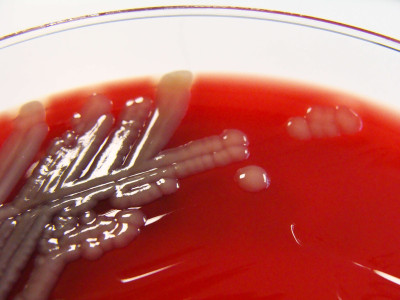 Aeromonas hydrophila on Columbia Horse Blood Agar - Detail