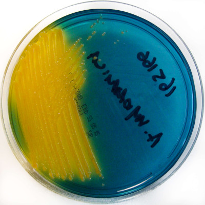 Aeromonas hydrophila on TCBS Agar