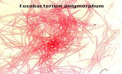 Fusobacterium polymorphum