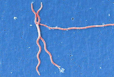 Lyme Disease Parasite Borrelia burgdorferi