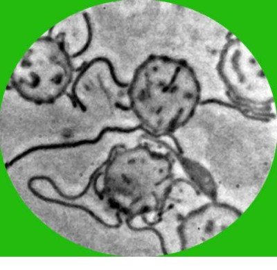 Morgellons-lyme-borrelia Bacteria