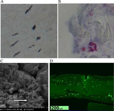 Morgellons 12895 2015 23 Fig2 HTML