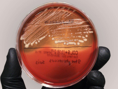 Rhodococcus spp.