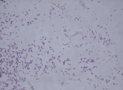 Rhodococcus fascians