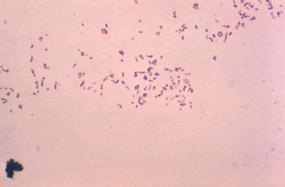 Rhodococcus equi CDC 15190